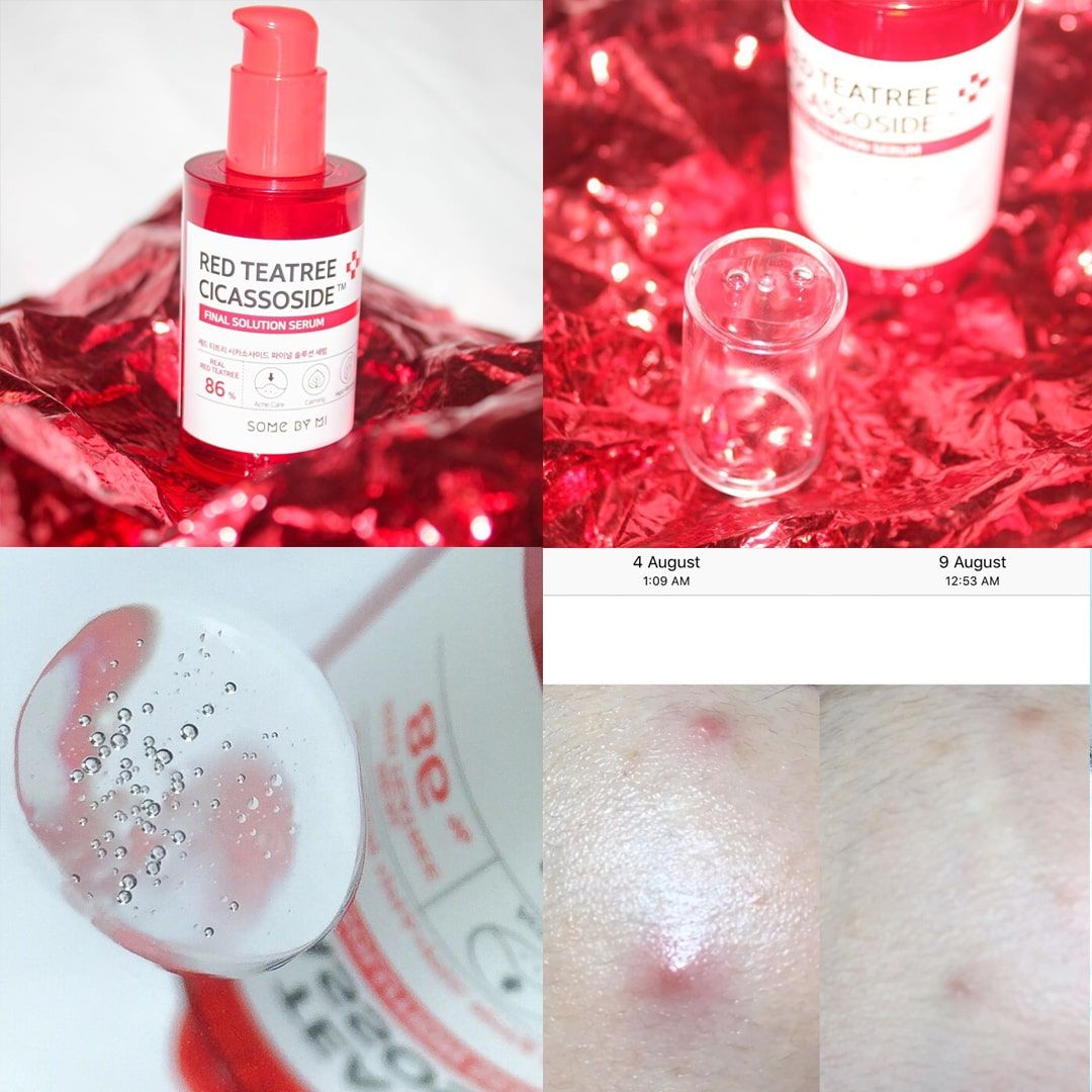Tinh chất Tràm Trà Đỏ Some By Mi Red Teatree Cicassoside Final Solution Serum 50ml