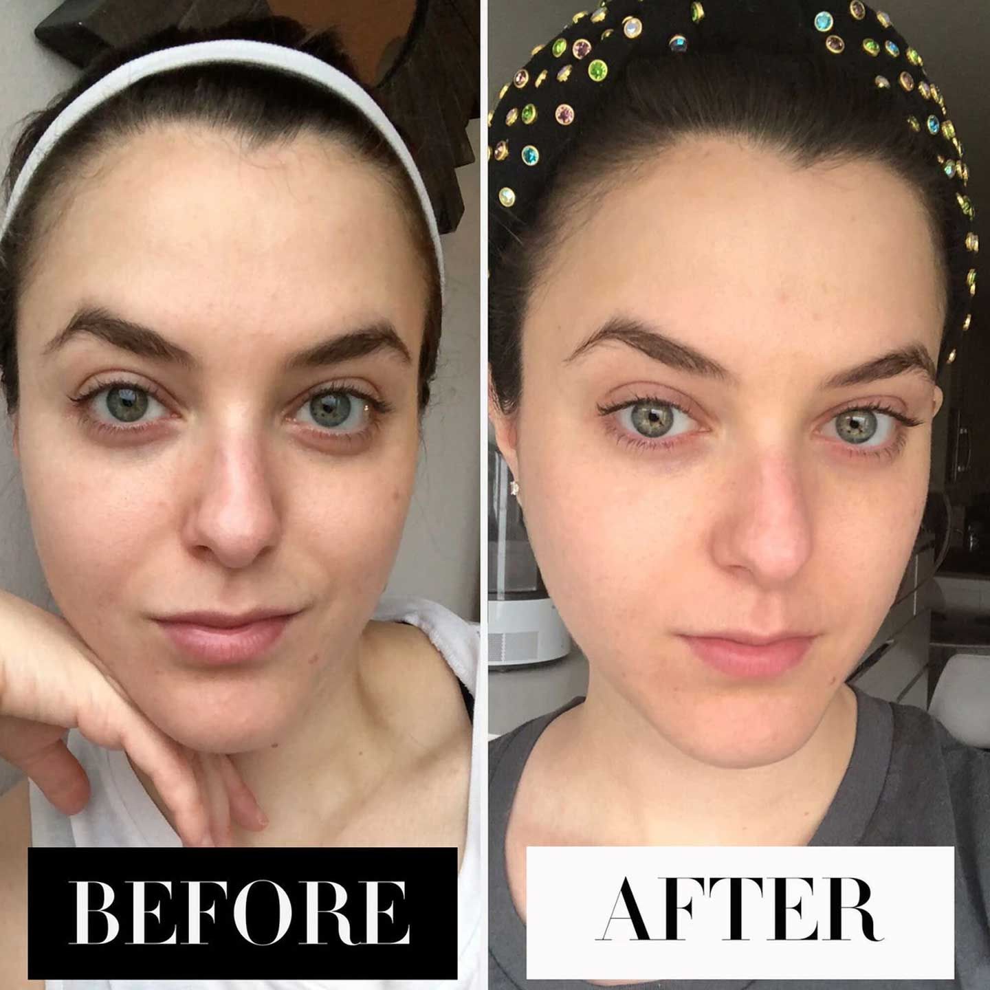 Dưỡng Mắt Serum The Ordinary Caffeine Solution 5% + EGCG