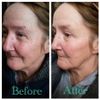 Instantly Ageless Kem Xóa Nêp Nhăn 2 Phút