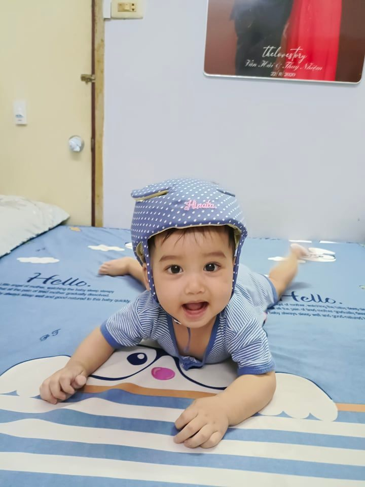 Nón bảo hộ đầu cho bé Hinata NBH02