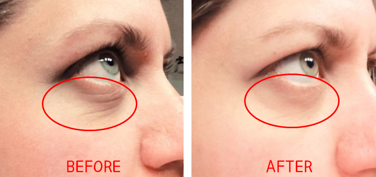 NATURAL DA RYO MI LIFT EYE SERUM