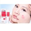 Kem cải thiện mụn Shiseido Pimlit 18g