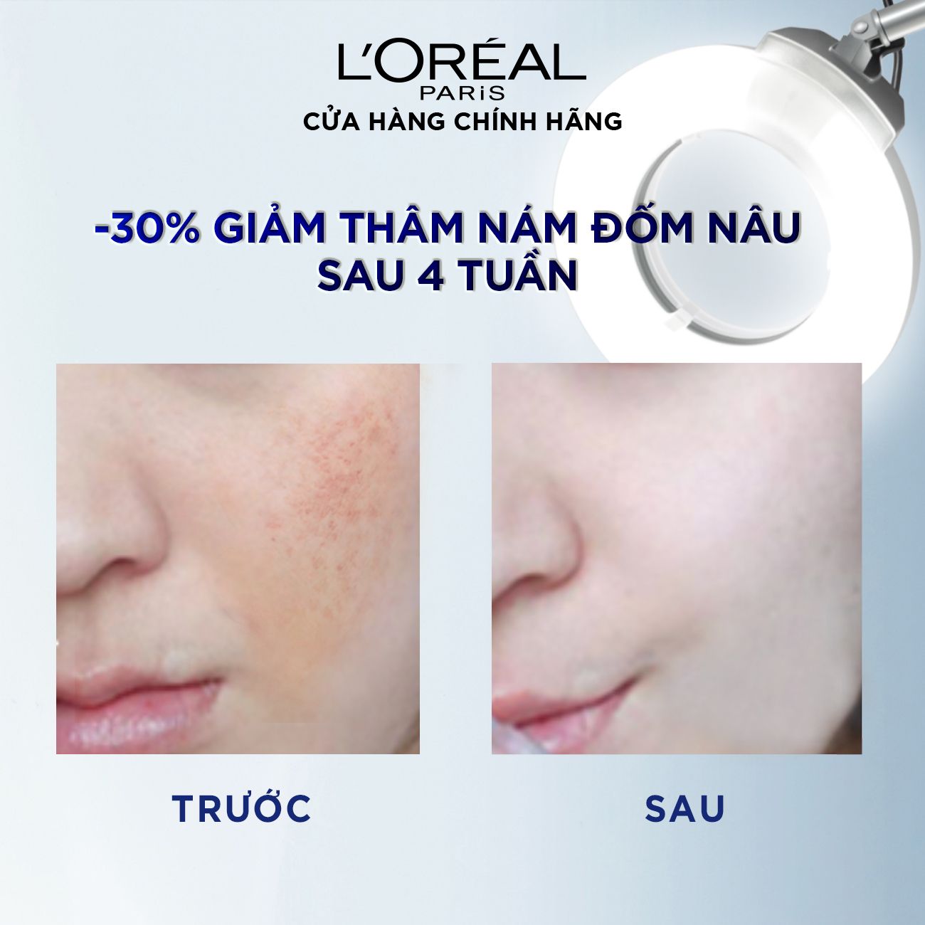 Kem dưỡng trắng mịn và giảm thâm nám ban ngày L'Oréal Paris White/ Aura Perfect Clinical SPF19/PA+++ 50ml