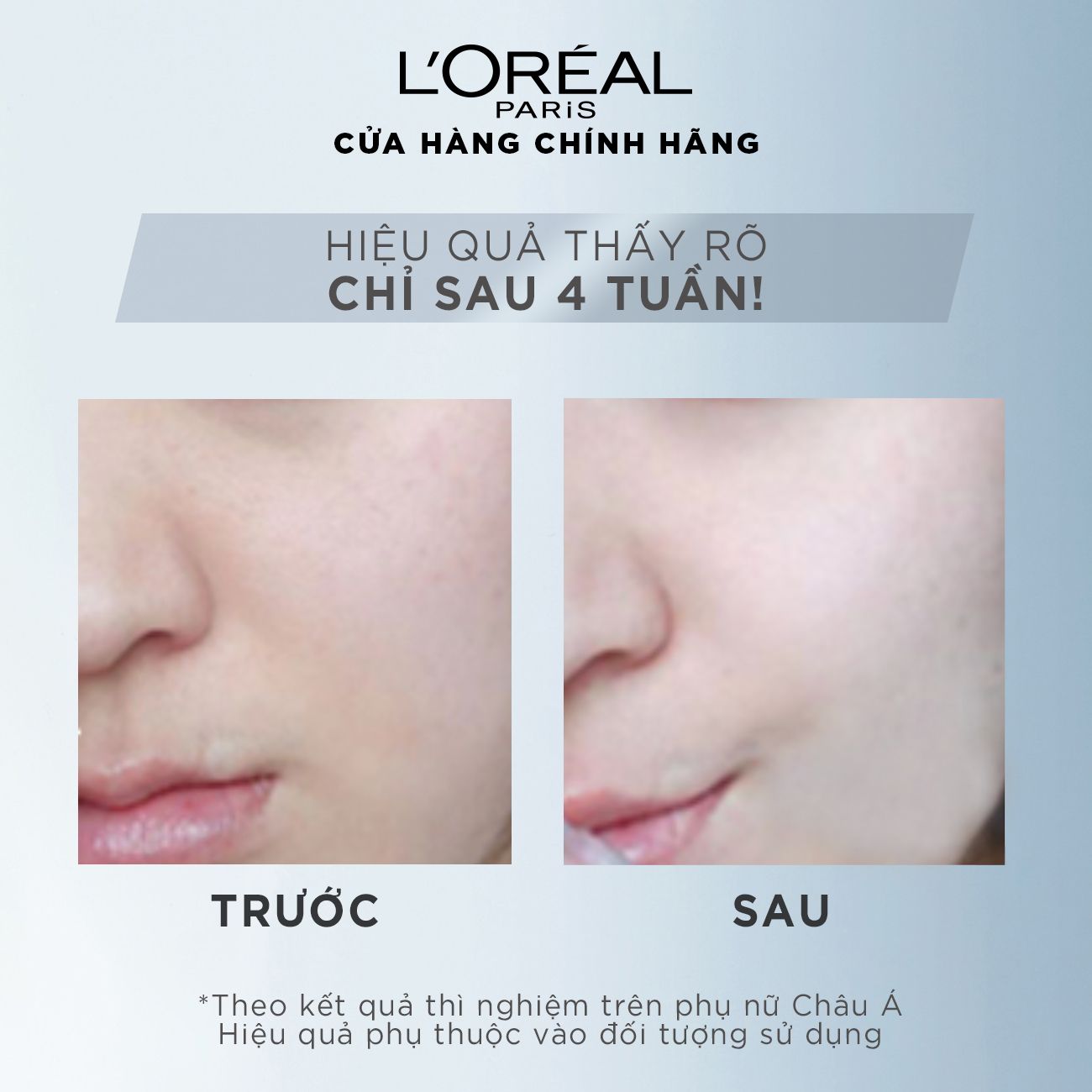 Tinh chất tăng cường dưỡng da trắng mịn & giảm thâm nám L'Oréal Paris White/ Aura Perfect Clinical 30ml