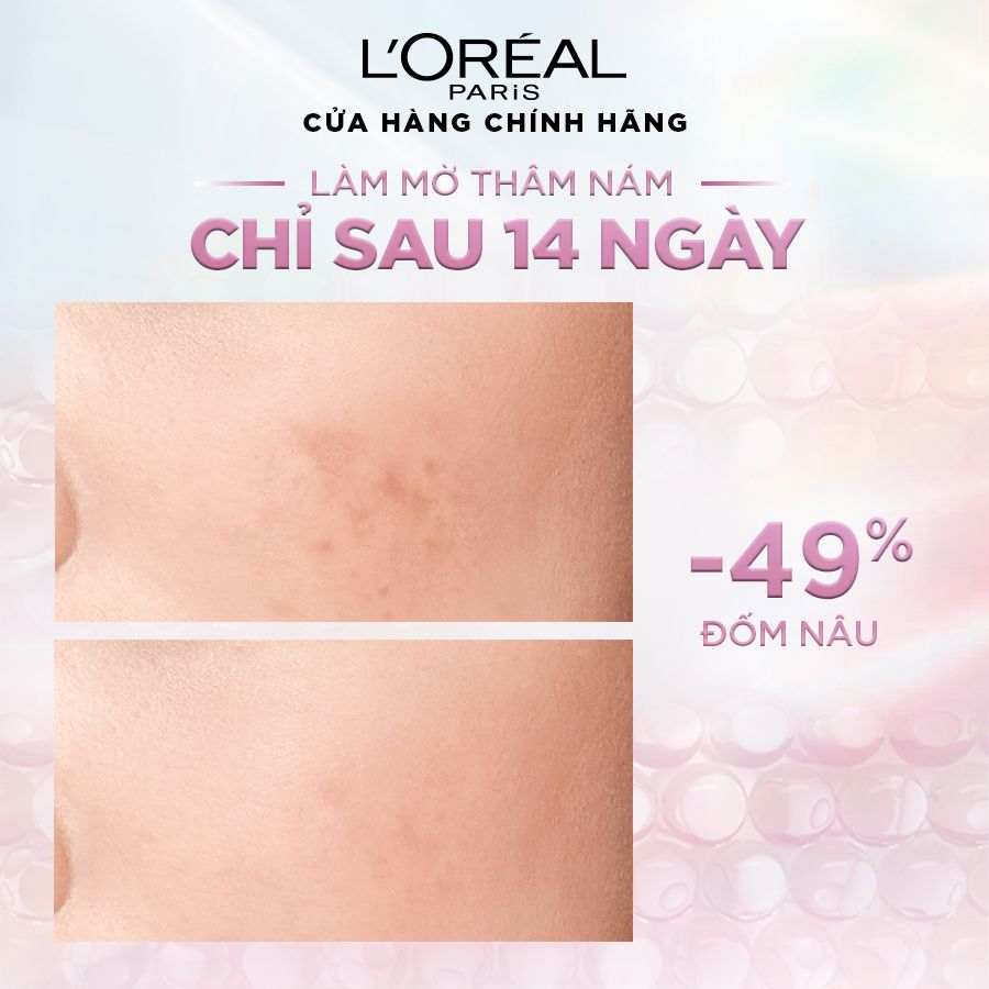 Serum Sáng Da Tức Thì L'Oreal Paris Glycolic - Bright Instant Glowing Serum 1.0% Glycolic Acid 15ML