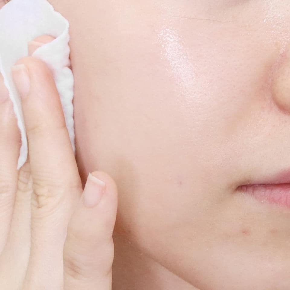 CENTELLA TROUBLE TONER NƯỚC HOA HỒNG MAMONDE