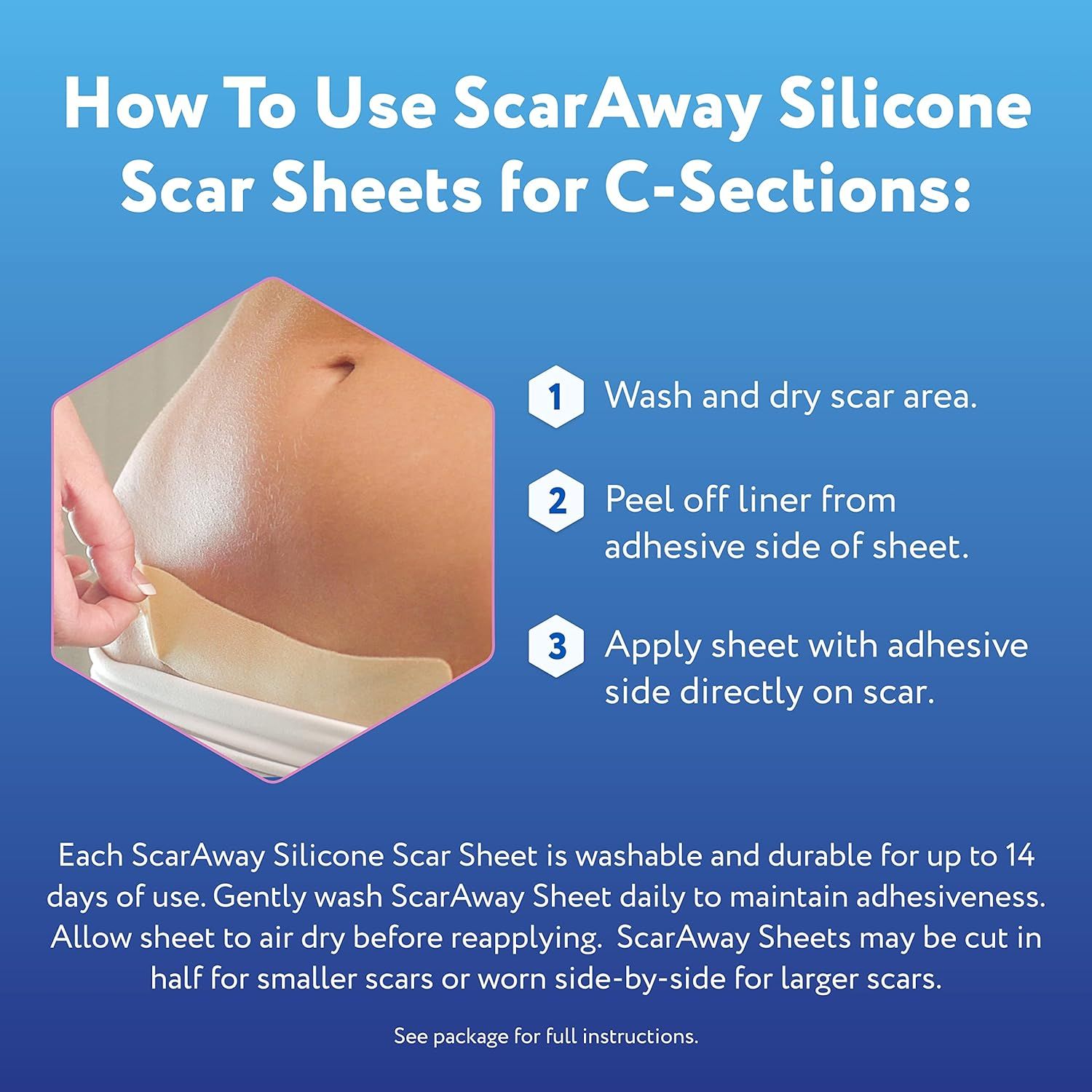  Miếng dán trị sẹo ScarAway for C-Sections 4 miếng 