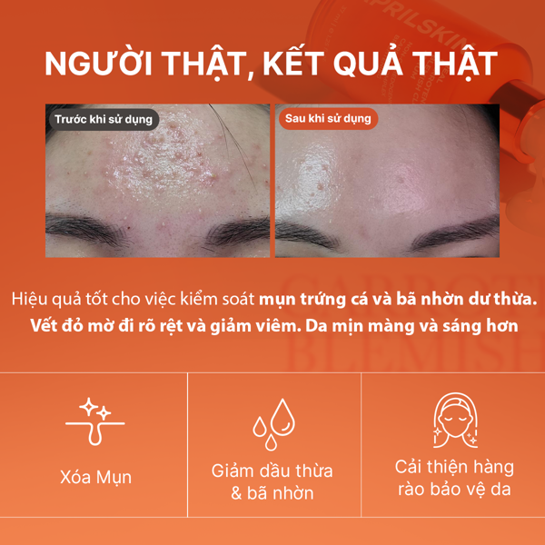Set full carrot khóa ẩm