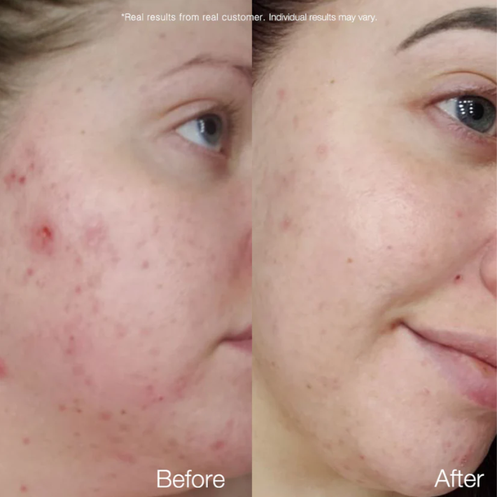 Tinh chất dưỡng da Carrotene Clarifying Serum *