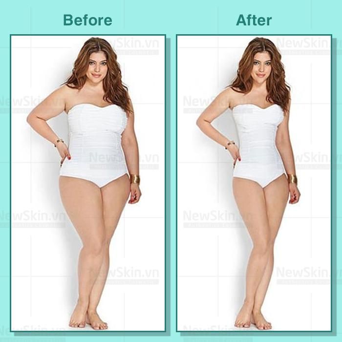 Tinh Chất Đốt Cháy Mỡ Tích Tụ Eveline Slim Extreme 3D Thermo Active Slimming Serum 250ml