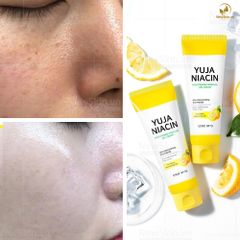 Kem Dưỡng Làm Trắng Da Some By Mi Yuja Niacin Brightening Moisture Gel Cream 100ml