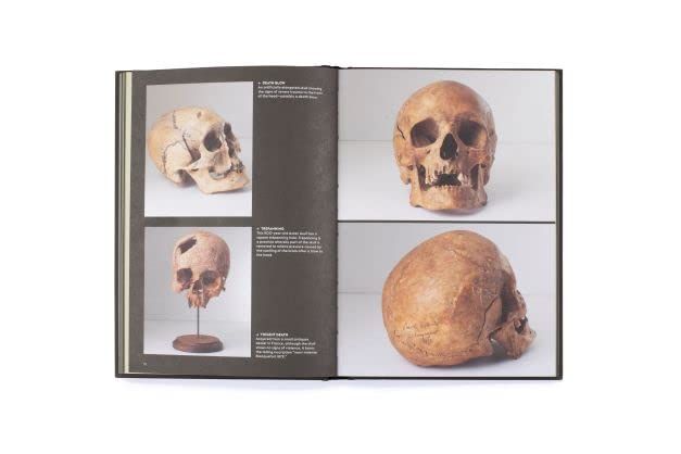 Skulls : Portraits of the Dead and the Stories They Tell