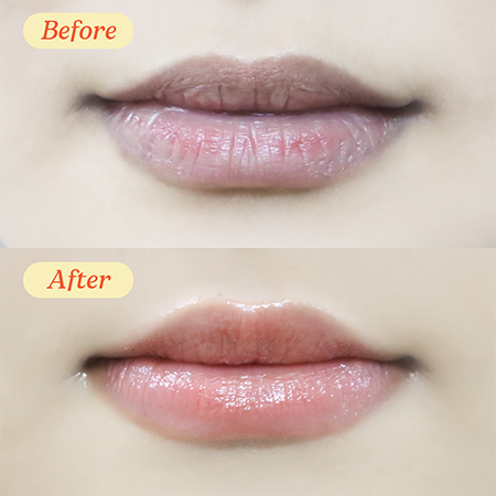 Mặt nạ ngủ cho môi kiêm son dưỡng Baresoul Best Kisser Lip Balm & Mask 10g
