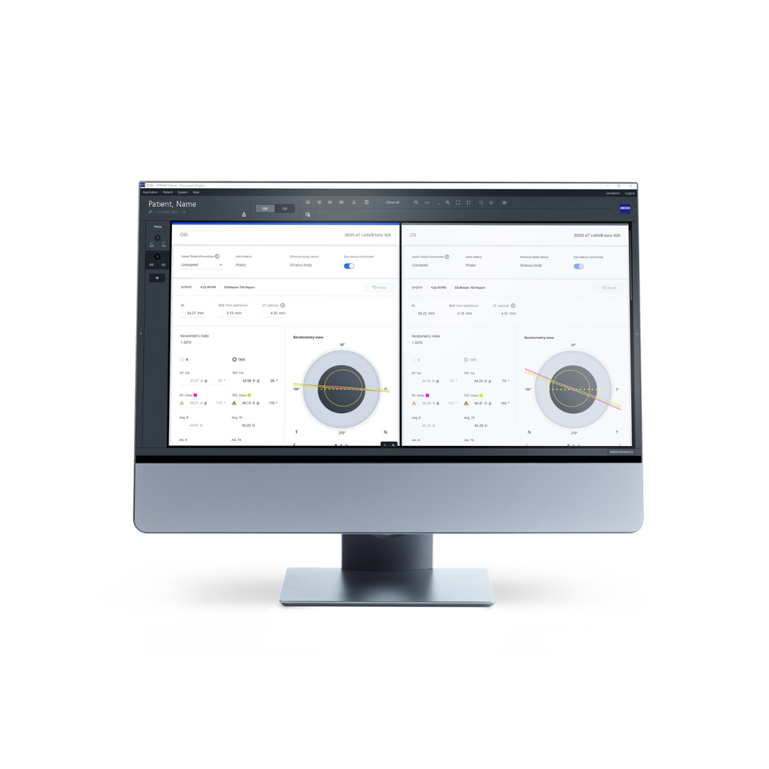 Giải pháp số Zeiss Cataract workflow - EQ workplace