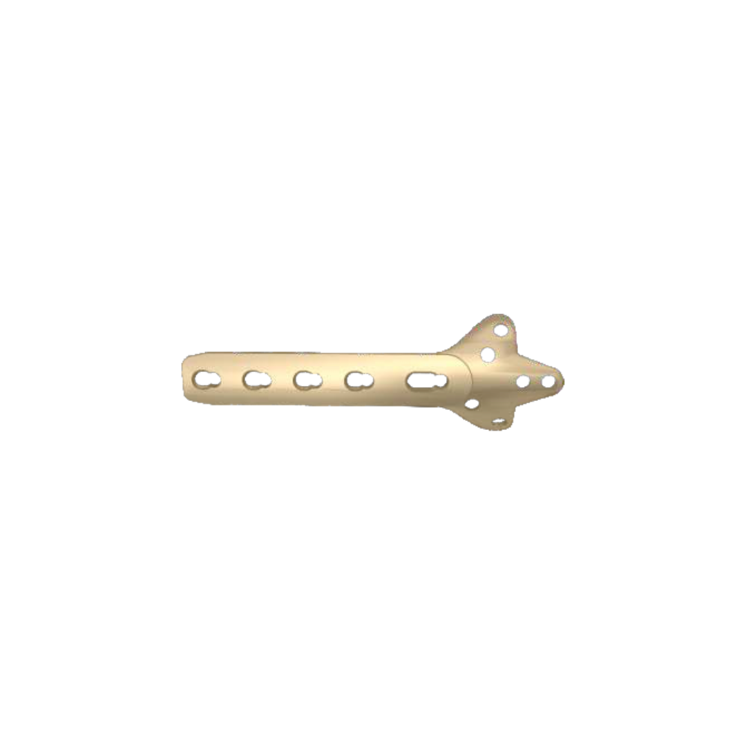 Nẹp khóa hình lá 3.5mm