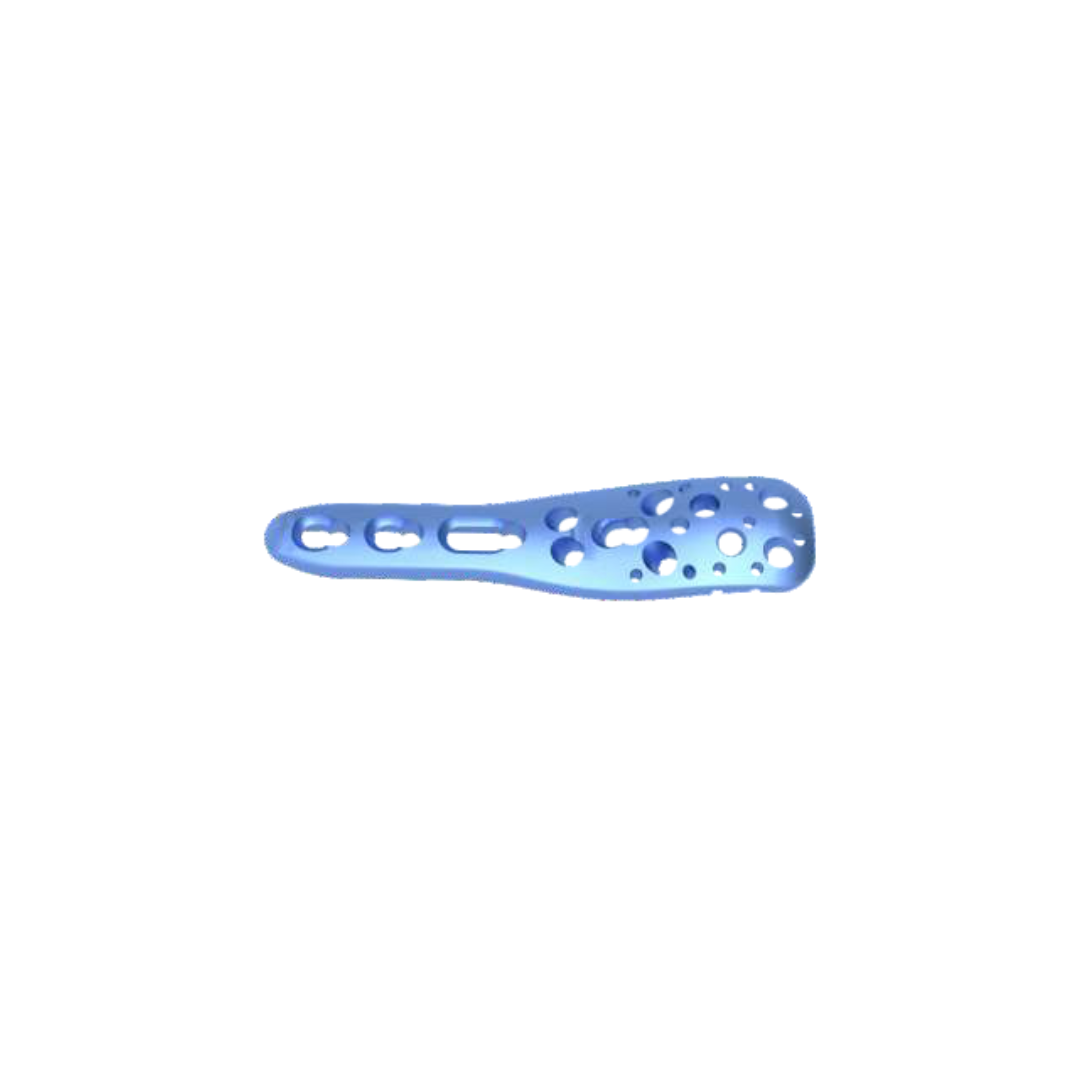 Nẹp khóa đầu trên xương cánh tay thân ngắn 3.5mm