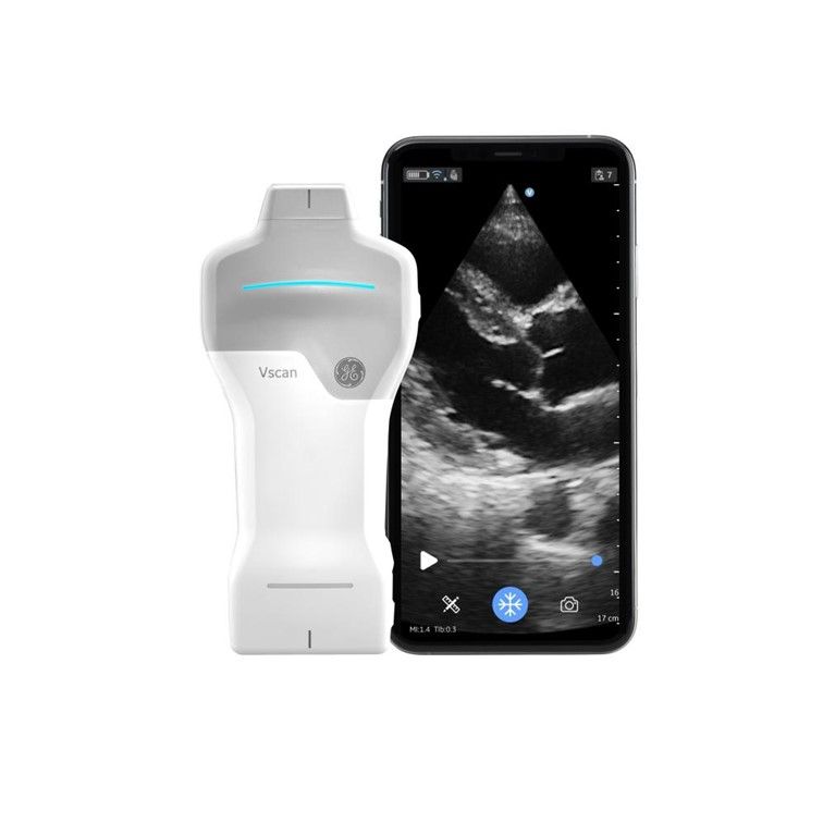 Máy siêu âm chẩn đoán Vscan Air SL