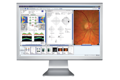 ZEISS Glaucoma Workplace