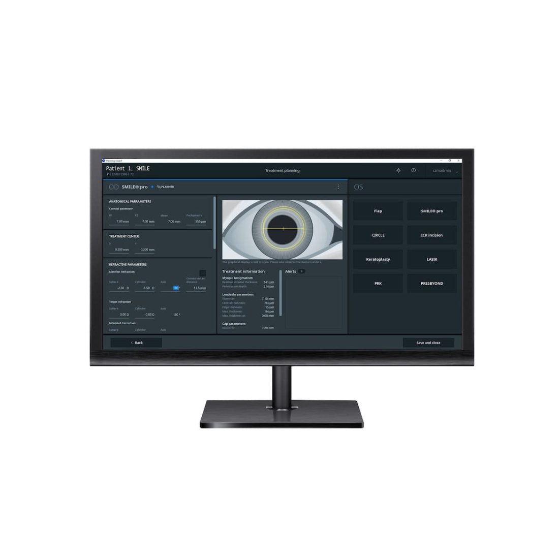 Giải pháp số Zeiss Refractive workflow - Refractive workplace