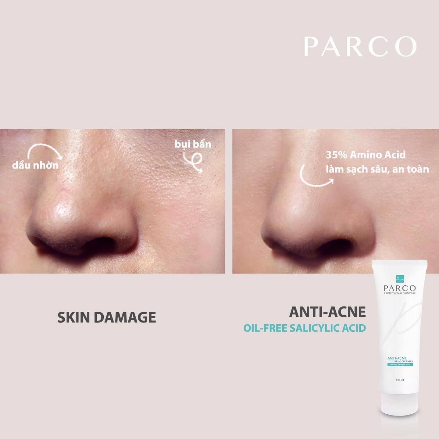 SỮA RỬA MẶT AMINO ACID NGĂN NGỪA MỤN PARCO (Oil-Free Salicylic Acid)