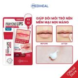  Son Dưỡng giảm Thâm và Khô Môi Mediheal Labocare Panteno Lips 