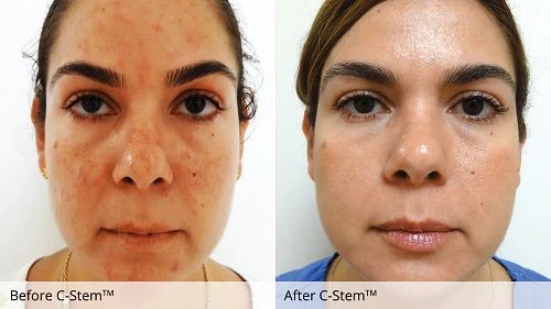 C-Stem 7 Solutions Serum