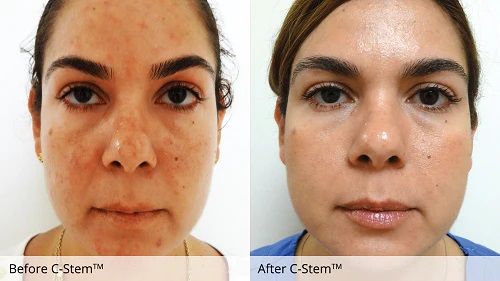  C-Stem 7 Solutions Serum 