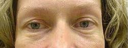 Ultra Firming Eye