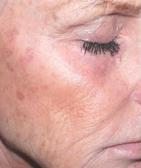 Advanced Retinol