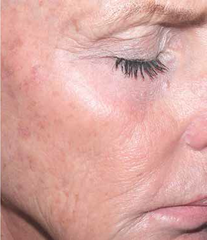 Advanced Retinol