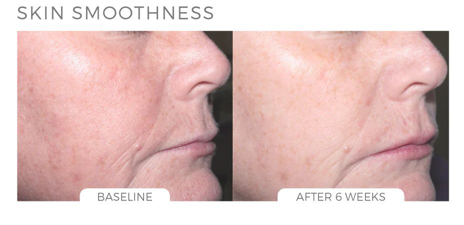  Skin brightening system 