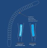 MIẾNG DÁN HỖ TRỢ ĐẦU GỐI KT TAPE KT FLEX