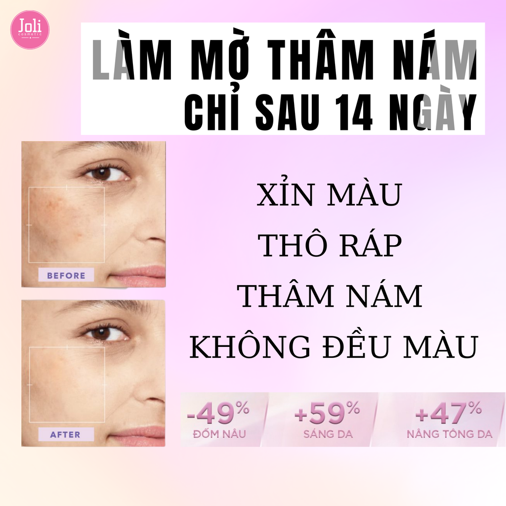 Kem Dưỡng Sáng Da Mờ Thâm Nám Ban Ngày Loreal Glycolic-Bright Glowing Cream Day SPF17 50ml