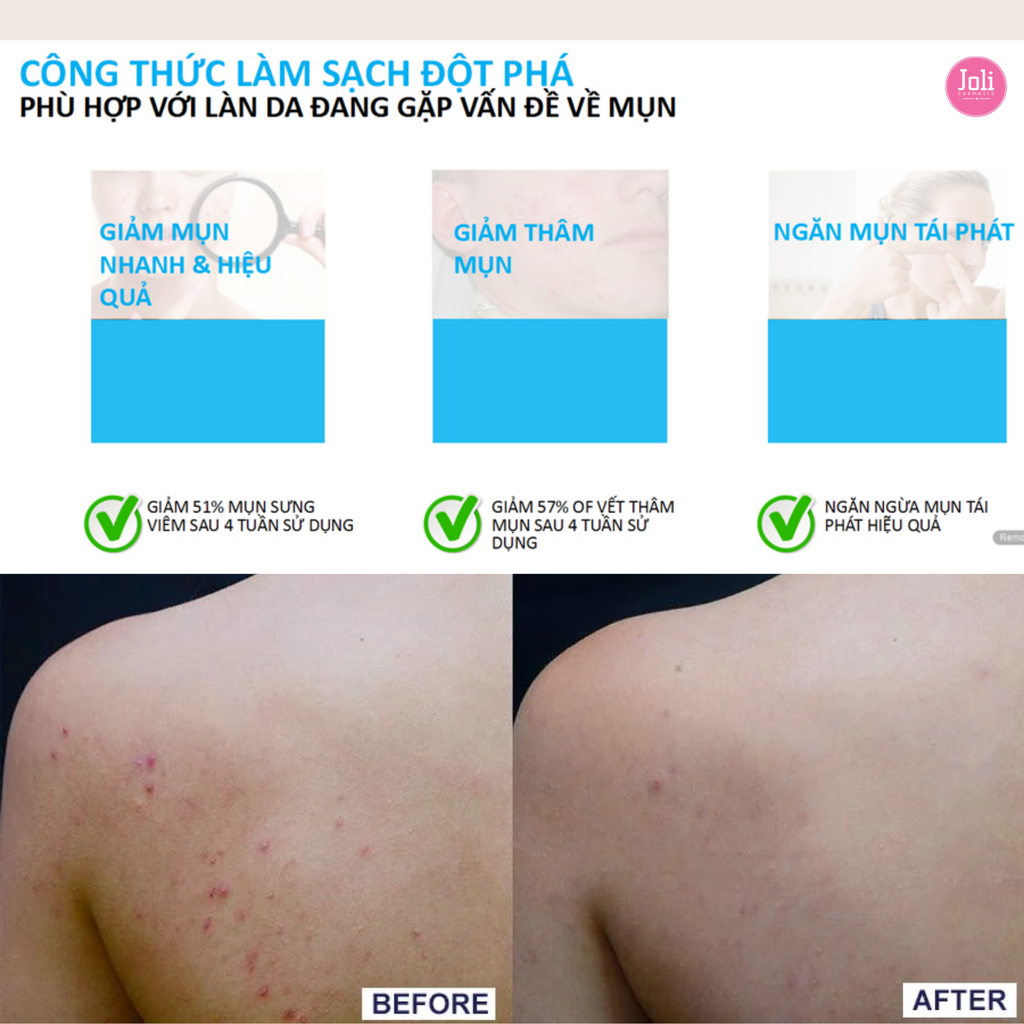 Gel Rửa Mặt & Tắm Làm Sạch Giảm Mụn La Roche-Posay Effaclar Micro-Peeling Purifying Gel 400ml