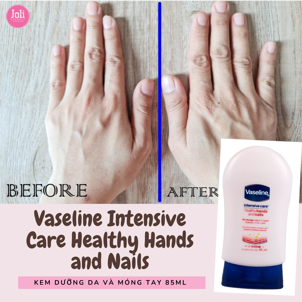 Kem Dưỡng Da Và Móng Tay Vaseline Intensive Care Healthy Hands and Nails 85ml
