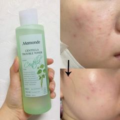 Nước Cân Bằng Mamonde Chiết Xuất Rau Má Cho Da Mụn Centella Trouble Toner 250ml