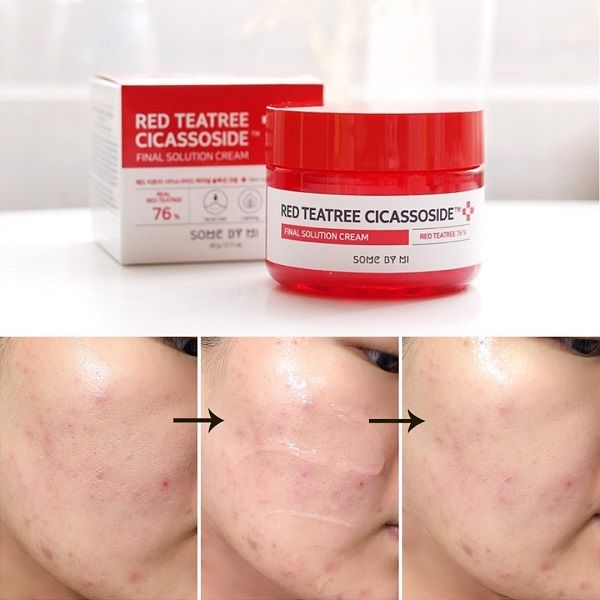 Kem Dưỡng Da Trị Mụn Some By Mi Red Tea Tree Cicassoside Final Solution Cream 60g