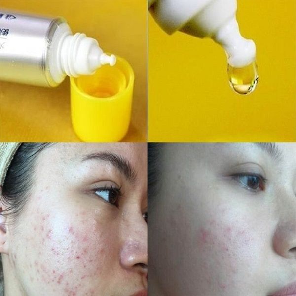 Serum trị thâm VItamin C Rohto Melano CC