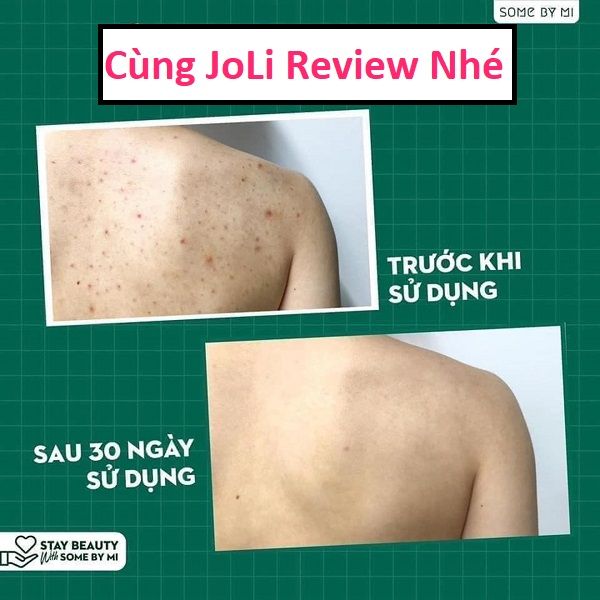 Xà bông trị mụn lưng Some By Mi
