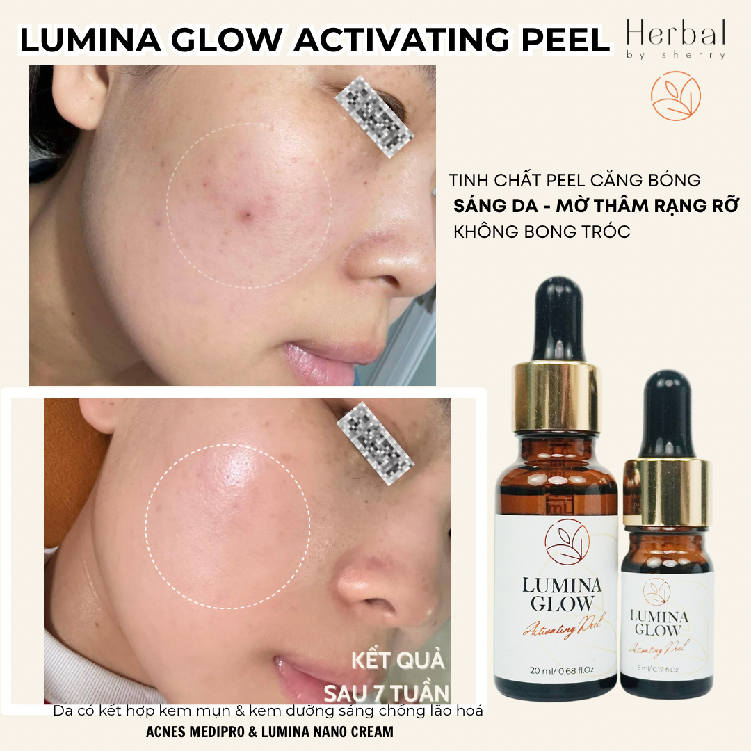 Tinh chất căng bóng sáng da-trẻ hoá LUMINA GLOW ACTIVATING PEEL hỗ trợ giảm thâm mụn, se lỗ chân lông