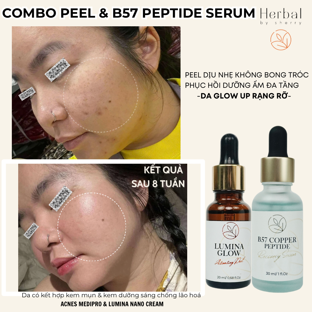 Tinh chất căng bóng sáng da-trẻ hoá LUMINA GLOW ACTIVATING PEEL hỗ trợ giảm thâm mụn, se lỗ chân lông
