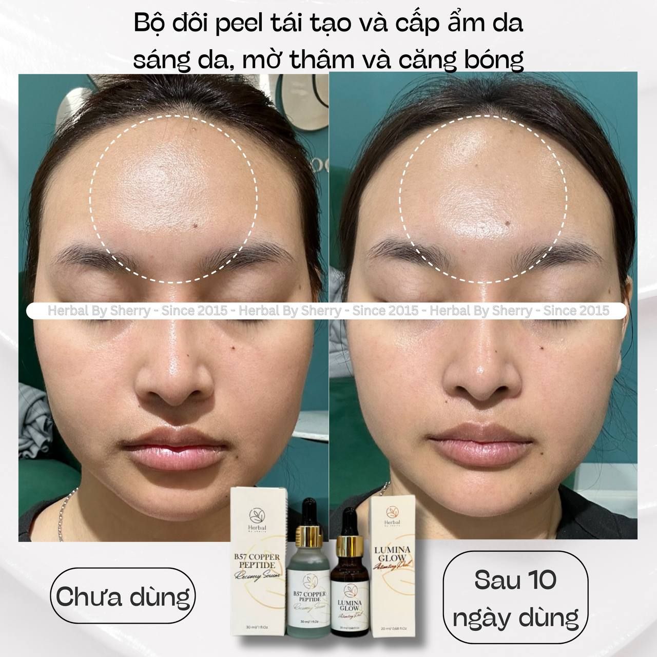 Tinh chất căng bóng sáng da-trẻ hoá LUMINA GLOW ACTIVATING PEEL hỗ trợ giảm thâm mụn, se lỗ chân lông