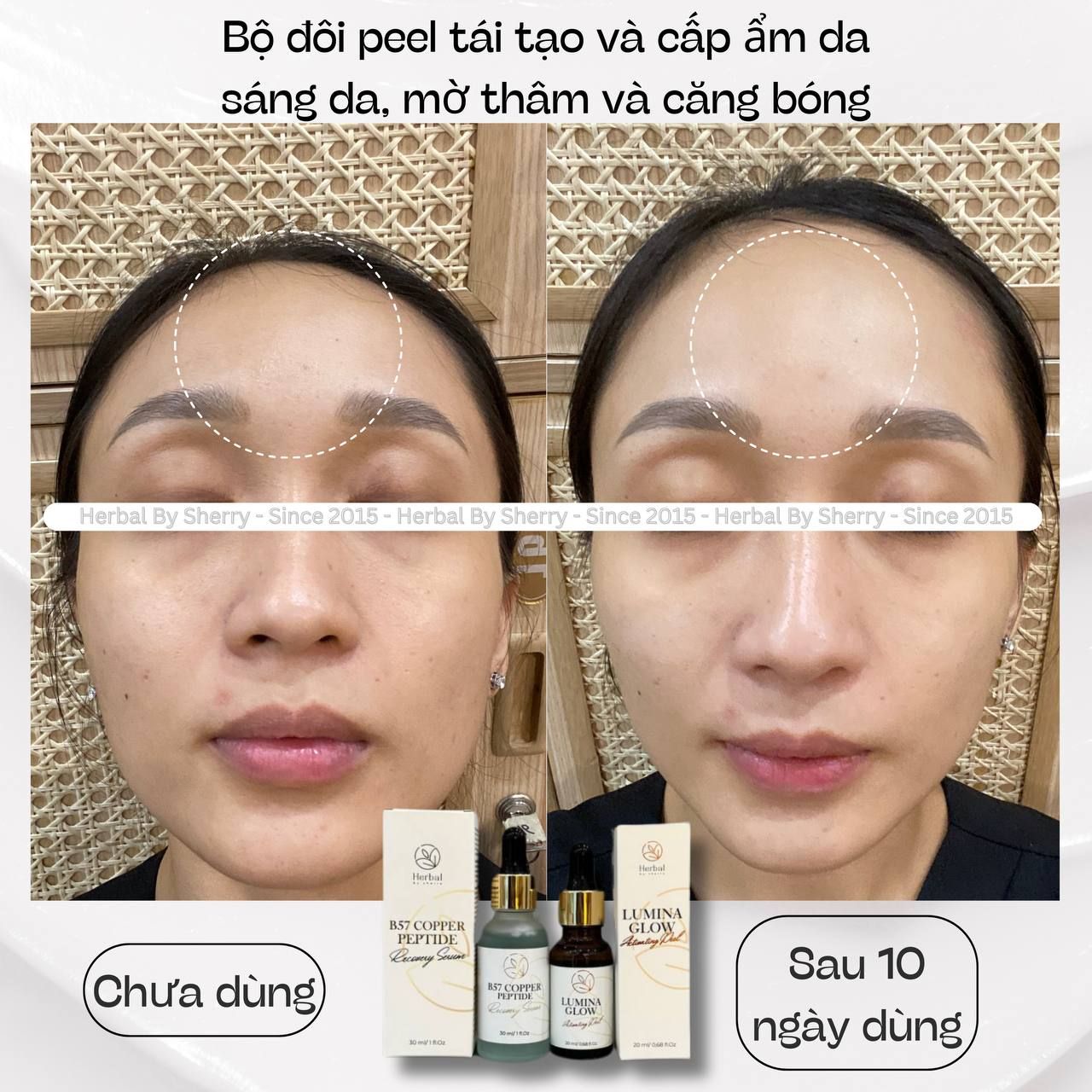Tinh chất căng bóng sáng da-trẻ hoá LUMINA GLOW ACTIVATING PEEL hỗ trợ giảm thâm mụn, se lỗ chân lông