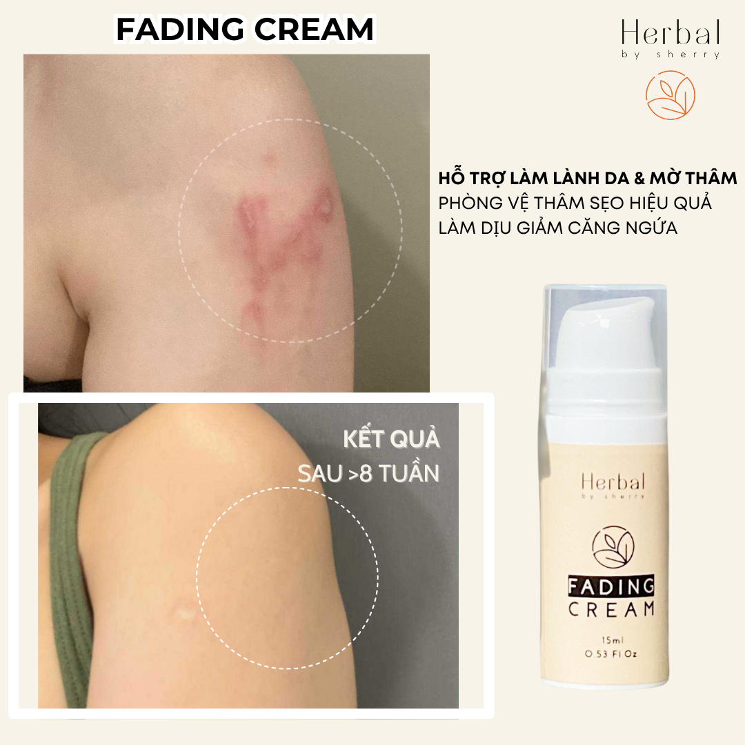 FADING CREAM - Kem làm mờ thâm