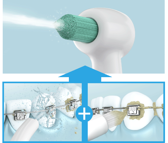  Đầu tăm nước chuyên dụng cho răng chỉnh nha WEW0984W251 