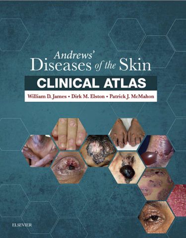 Andrews' Diseases of the Skin Clinical Atlas