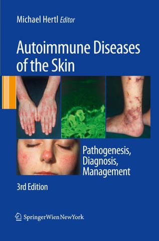 Autoimmune Diseases of the Skin: Pathogenesis, Diagnosis, Management