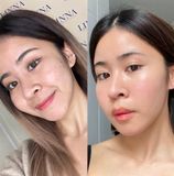 Mặt Nạ Phục Hồi Căng Bóng Trẻ Hoá Da Rejuran Healer Skin Protection Mask 27ml