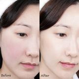 Tinh Chất Dưỡng Ẩm Phục Hồi Torriden Dive In Low Molecular Hyaluronic Acid Serum 50ml