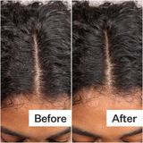 Tinh Chất Dưỡng Ẩm Da Đầu Act+Acre Daily Hydro Scalp Serum 15ml